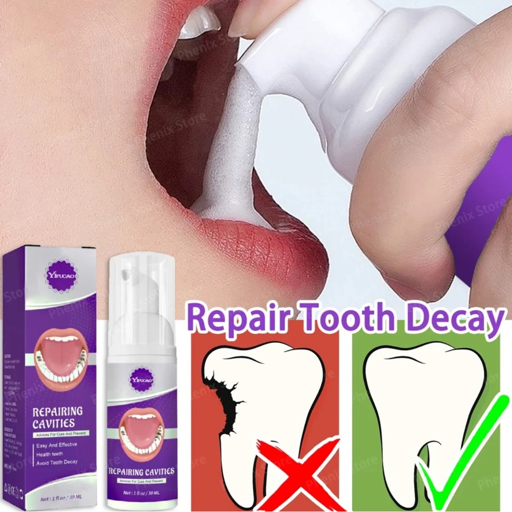 Repair Cavities Caries Removal of Plaque Stains Decay Yellowing Teeth Whitening